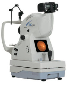 Fundus Camera untuk pengambilan gambar detail retina dan saraf optik