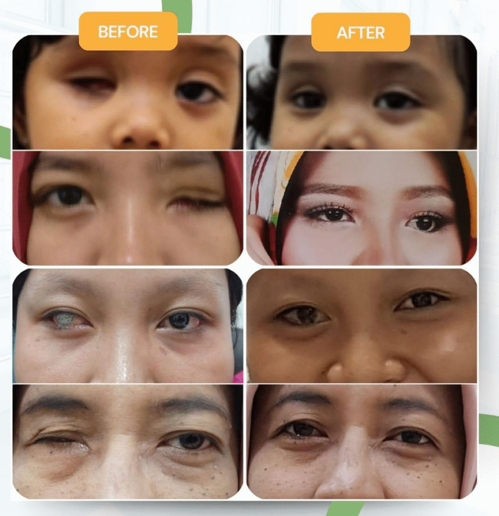 Contoh Penggunaan Mata Palsu