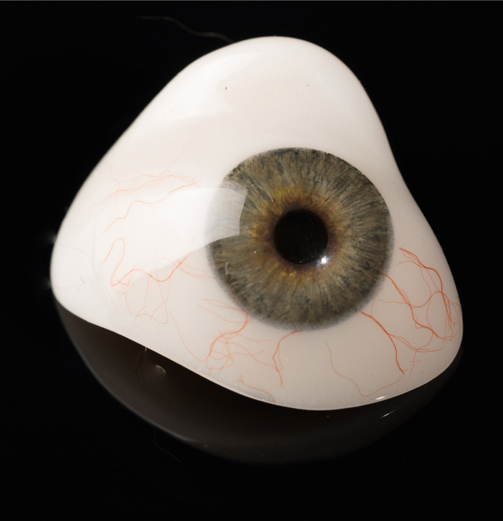 Mata Palsu (Protesa Mata)